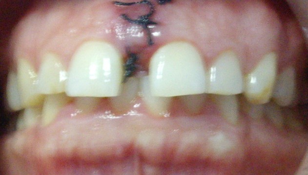 foto 1 recortada